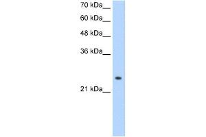 ADH6 antibody used at 1. (ADH6 antibody)