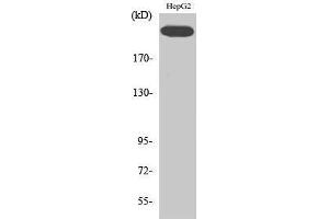 Western Blotting (WB) image for anti-VEGF Receptor 2 (VEGFR2) (pTyr1214) antibody (ABIN3182010) (VEGFR2/CD309 antibody  (pTyr1214))