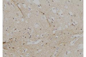 ABIN6274545 at 1/100 staining Human brain tissue by IHC-P. (FOXD3 antibody  (Internal Region))