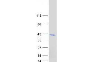 Western Blotting (WB) image for Alcohol Dehydrogenase 6 (Class V) (ADH6) (Transcript Variant 1) protein (Myc-DYKDDDDK Tag) (ABIN2714532)