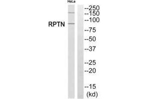 Western blot analysis of extracts from HeLa cells, using RPTN antibody. (Repetin antibody  (C-Term))