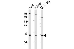 Western blot analysis of lysates from Hela cell line, human liver and mouse kidney tissue lysate(from left to right), using CDA Antibody (Center) (ABIN389394 and ABIN2839486). (CDA antibody  (AA 51-83))