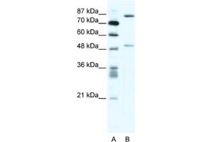 Western Blotting (WB) image for anti-Matrix Metallopeptidase 10 (Stromelysin 2) (MMP10) antibody (ABIN2463709) (MMP10 antibody)