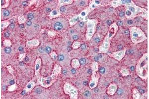 Human Liver (formalin-fixed, paraffin-embedded) stained with LRP1 antibody ABIN337392 at 10 ug/ml followed by biotinylated anti-mouse IgG secondary antibody ABIN481714, alkaline phosphatase-streptavidin and chromogen. (LRP1 antibody)