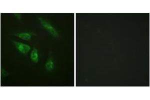 Immunofluorescence analysis of HeLa cells, using NFAT3 (Ab-676) Antibody. (NFATC4 antibody  (AA 642-691))
