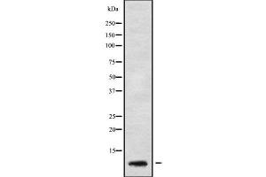 Western blot analysis GNG5 using HeLa whole cell lysates (GNG5 antibody  (Internal Region))