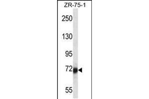 Western blot analysis in ZR-75-1 cell line lysates (35ug/lane). (SP100 antibody  (N-Term))