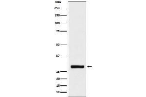 Western blot analysis of BRMS1 expression in HeLa cell lysate. (Recombinant BRMS1 antibody)