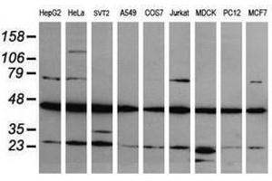 Image no. 1 for anti-Mitogen-Activated Protein Kinase Kinase 1 (MAP2K1) antibody (ABIN1499378) (MEK1 antibody)