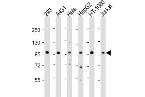 All lanes : Anti-DDX21 Antibody (N-term) at 1:2000 dilution Lane 1: 293 whole cell lysate Lane 2: A431 whole cell lysate Lane 3: Hela whole cell lysate Lane 4: HepG2 whole cell lysate Lane 5: HT-1080 whole cell lysate Lane 6: Jurkat whole cell lysate Lysates/proteins at 20 μg per lane. (DDX21 antibody  (N-Term))