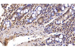 Detection of FBLN3 in Human Small intestine Tissue using Monoclonal Antibody to Fibulin 3 (FBLN3) (FBLN3 antibody  (AA 26-213))