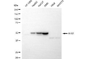 Western blotting analysis using ALG2 antibody (ABIN7797663). (ALG2 antibody)