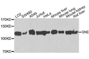 Western blot analysis of extracts of various cell lines, using GNE antibody (ABIN5996449) at 1/1000 dilution.