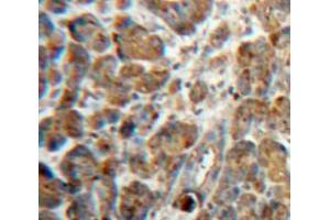Used in DAB staining on fromalin fixed paraffin-embedded Pancreas tissue (NPTX2 antibody  (AA 111-367))