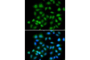 Immunofluorescence analysis of HeLa cells using MXI1 antibody (ABIN5974012).