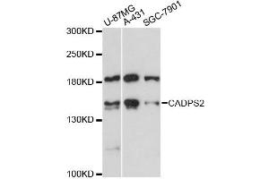 Western blot analysis of extracts of various cell lines, using CADPS2 antibody (ABIN6292762) at 1:3000 dilution.