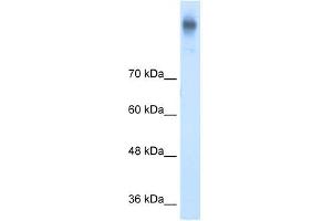 Western Blot showing SLC12A2 antibody used at a concentration of 1-2 ug/ml to detect its target protein. (SLC12A2 antibody)