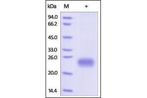Human GITR, His Tag on SDS-PAGE under reducing (R) condition. (TNFRSF18 Protein (AA 26-161) (His tag))