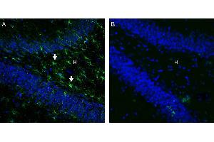 Expression of GPR43/FFAR2 in rat hippocampus.