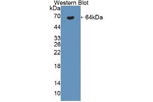 Figure. (Bestrophin 1 antibody  (AA 292-585))