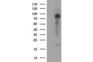 HEK293T cells were transfected with the pCMV6-ENTRY control (Left lane) or pCMV6-ENTRY TACC3 (Right lane) cDNA for 48 hrs and lysed. (TACC3 antibody)