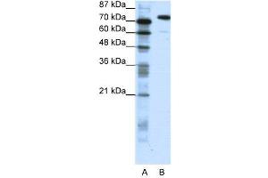 WB Suggested Anti-SATB1  Antibody Titration: 1. (SATB1 antibody  (C-Term))