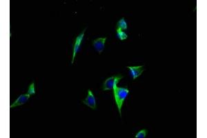 Immunofluorescence staining of A549 cells with ABIN7146408 at 1:100, counter-stained with DAPI. (ATP2C2 antibody  (AA 621-702))