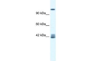WB Suggested Anti-GRIN2C Antibody Titration:  0. (GRIN2C antibody  (N-Term))