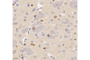 Immunohistochemistry analysis of paraffin-embedded rat brain using VMAT2 (ABIN7075655) at dilution of 1: 1600 (SLC18A2 antibody)