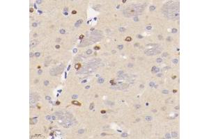 Immunohistochemistry analysis of paraffin-embedded rat brain using VMAT2 (ABIN7075655) at dilution of 1: 1600 (SLC18A2 antibody)
