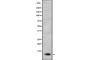Western blot analysis of NDUFB2 expression in A673 lysate;,The lane on the left is treated with the antigen-specific peptide.