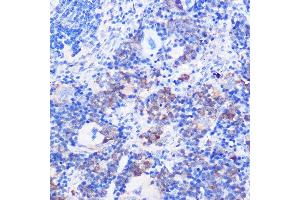Immunohistochemistry of paraffin-embedded mouse spleen using CD24 Rabbit pAb (ABIN1512696, ABIN3023213, ABIN3023214 and ABIN6219443) at dilution of 1:100 (40x lens). (CD24 antibody  (AA 1-80))