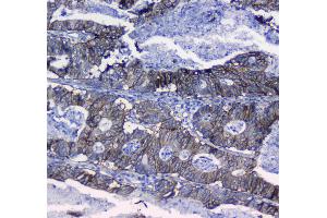 IHC analysis of Integrin alpha 5 using anti-Integrin alpha 5 antibody . (ITGA5 antibody  (AA 42-263))