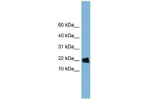 WB Suggested Anti-GOLGA7 Antibody Titration: 0. (Golgin A7 antibody  (Middle Region))