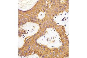 Immunohistochemical analysis of paraffin-embedded H. (RAC1 antibody)