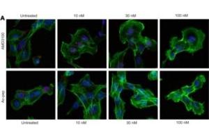 HMGB1 CXCL12 : the first fuzzy chemokines heterocomplex reported so far