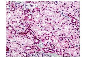 Human Kidney: Formalin-Fixed, Paraffin-Embedded (FFPE) (STEAP2 antibody  (AA 455-467))