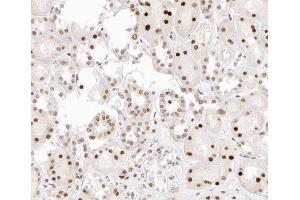 ABIN6267407 at 1/200 staining human kidney tissue sections by IHC-P. (PKC alpha antibody  (pThr638))