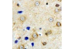 Immunohistochemical analysis of VILIP-1 staining in mouse brain formalin fixed paraffin embedded tissue section. (VSNL1 antibody)