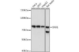 Western blot analysis of extracts of various cell lines, using SNX1 Rabbit mAb (ABIN7270502) at 1:1000 dilution. (Sorting Nexin 1 antibody)