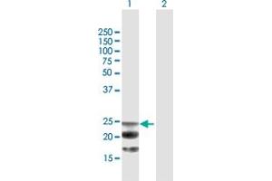 Western Blot analysis of NAAA expression in transfected 293T cell line by NAAA MaxPab polyclonal antibody. (NAAA antibody  (AA 1-199))