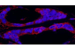 Immunofluorescence (IF) image for anti-Ribosomal Protein S6 Kinase, 90kDa, Polypeptide 1 (RPS6KA1) (AA 375-425) antibody (ABIN7453399)