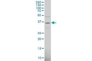 TRIM6-TRIM34 polyclonal antibody (A01), Lot # 051115JCO1 Western Blot analysis of TRIM6-TRIM34 expression in Hela S3 NE . (TRIM6-TRIM34 antibody  (AA 641-740))