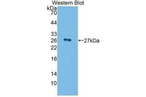 Detection of Recombinant CFH, Rat using Monoclonal Antibody to Complement Factor H (CFH) (Complement Factor H antibody  (AA 975-1217))