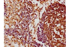 IHC image of ABIN7152658 diluted at 1:100 and staining in paraffin-embedded human lymph node tissue performed on a Leica BondTM system. (FCRL3 antibody  (AA 122-222))