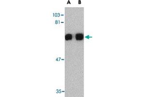 Western blot analysis of PRDM1 in A-549 cell lysate with PRDM1 polyclonal antibody  at (A) 0. (PRDM1 antibody  (C-Term))