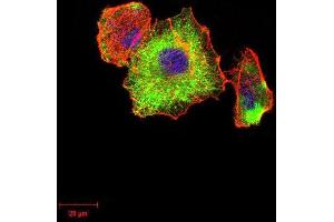 Immunocytochemistry (ICC) image for anti-Tubulin, beta 1 (TUBB1) (AA 33-166) antibody (ABIN5879491) (TUBB1 antibody  (AA 33-166))