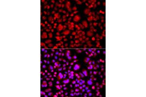 Immunofluorescence analysis of A549 cell using TP53BP2 antibody. (TP53BP2 antibody)