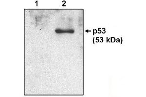 Western Blotting (WB) image for anti-Tumor Protein P53 (TP53) (AA 371-380) antibody (ABIN264449) (p53 antibody  (AA 371-380))