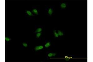 Immunofluorescence of monoclonal antibody to CSE1L on HeLa cell. (Exportin 2 antibody  (AA 872-971))